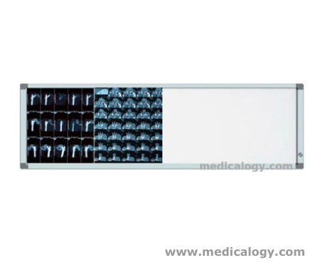 harga Alina X Ray Film Viewer Triple 3 Panel