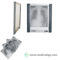 X Ray Film Viewer Single Onemed PD-GA
